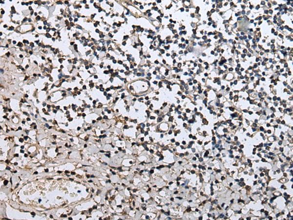 ZFP36 / Tristetraprolin Antibody