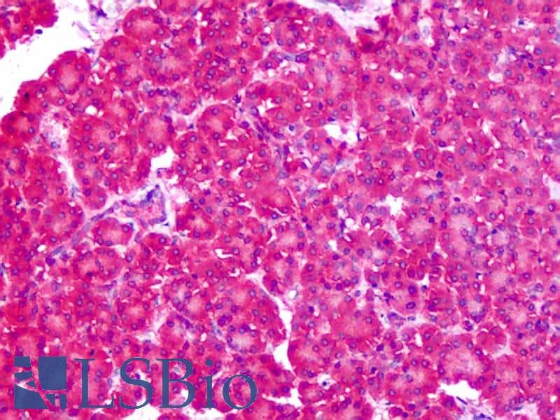 IHC-plus™ SLC1A4 / ASCT1 Antibody (N-Terminus)