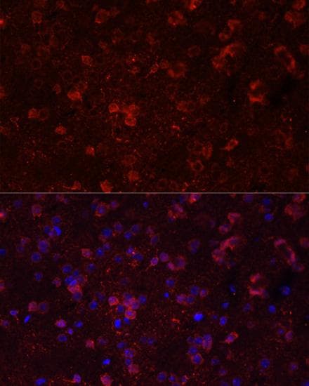 GRIN2B / NMDAR2B / NR2B Antibody