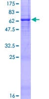 Human OGFOD3 Protein (Recombinant GST)