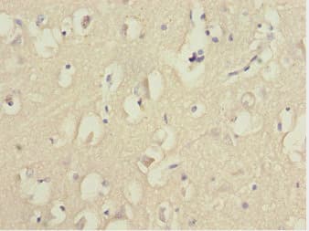 FOXN2 Antibody