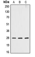 Polyclonal Rabbit anti-Human CTSD / Cathepsin D Antibody (Internal, WB)