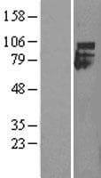 IFNAR1 / IFNAR Protein (Over-Expression Lysate Myc-DDK (Flag))