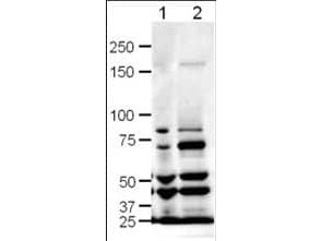 IHC-plus™ SLIT1 Antibody