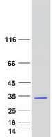 Human RAB34 Protein (Recombinant Myc-DDK (Flag))