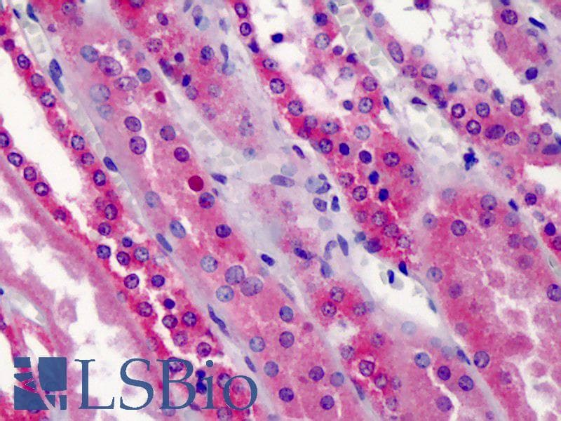 IHC-plus™ TRAF5 Antibody (aa77-186, clone 55A219)