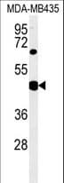 SH2D2A Antibody (aa86-112)