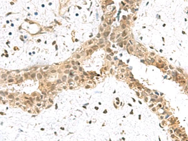TCEB1 / Elongin C Antibody