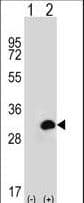 Polyclonal Rabbit anti-Human CA1 / Carbonic Anhydrase I Antibody (aa60-90, IHC, WB)