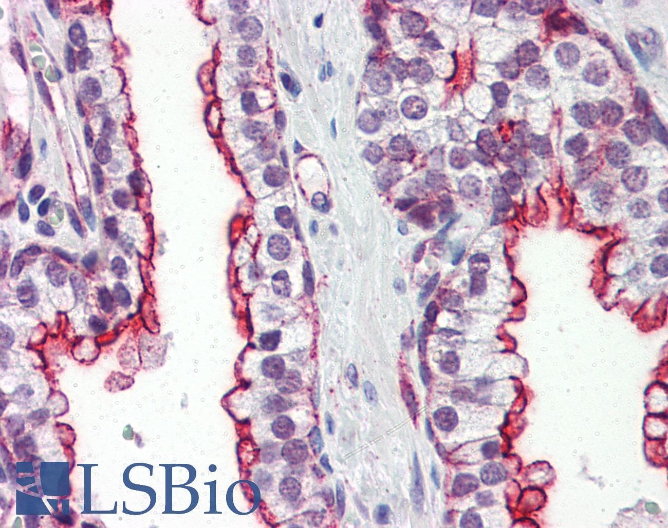 IHC-plus™ CLU / Clusterin Antibody (aa1-333, clone 1A11)