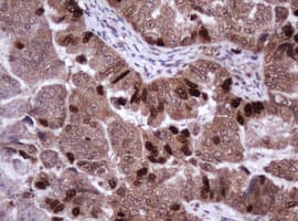 Monoclonal Mouse anti-Human MKI67 / Ki67 Antibody (clone OTI8H5, IHC)