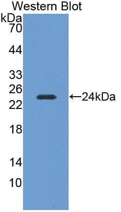 NEI3 / NEIL3 Antibody (aa2-187, Biotin)