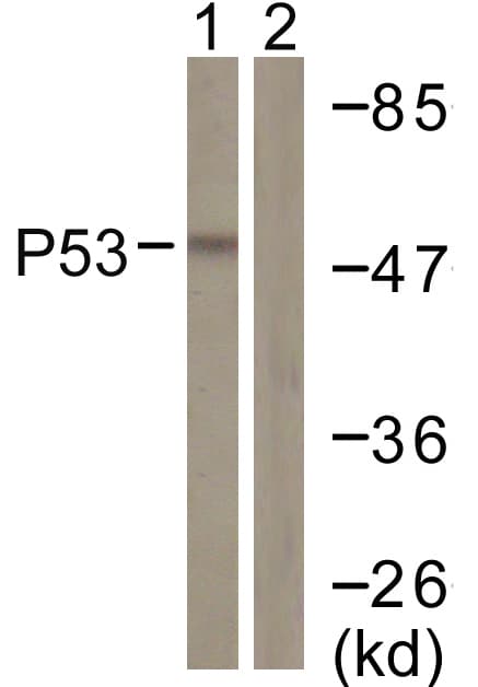 IHC-plus™ Polyclonal Rabbit anti-Human TP53 / p53 Antibody (aa344-393, IHC, IF, WB)