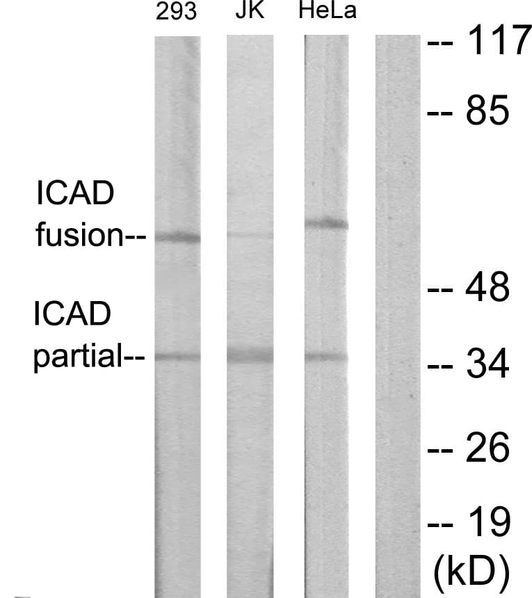 DFFA / ICAD / DFF45 Antibody (aa151-200)