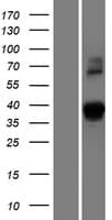 DSN1 Protein (Over-Expression Lysate Myc-DDK (Flag))