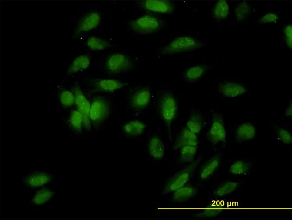 E6AP / UBE3A Antibody (clone 2F6)
