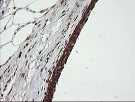 OTUB1 / OTU1 Antibody (clone OTI5F7)