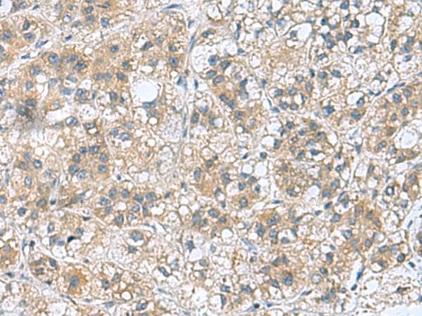 Polyclonal Rabbit anti-Human RAB39 / RAB39A Antibody (IHC)