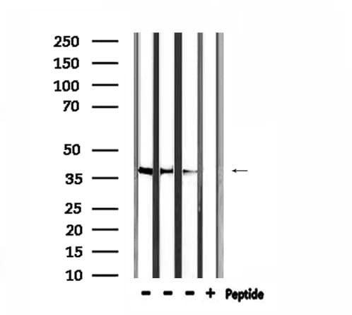 HTR1F / 5-HT1F Receptor Antibody