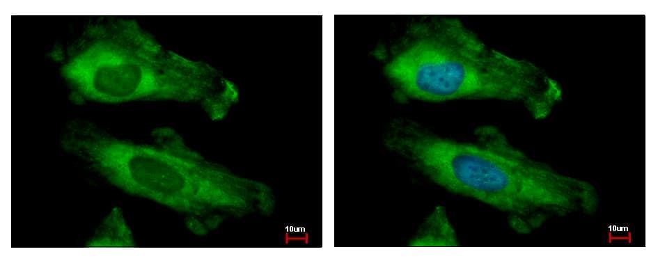 RPS10 / Ribosomal Protein S10 Antibody (aa1-151)