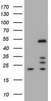 ZSCAN4 Antibody (aa164-433, clone OTI1E7)