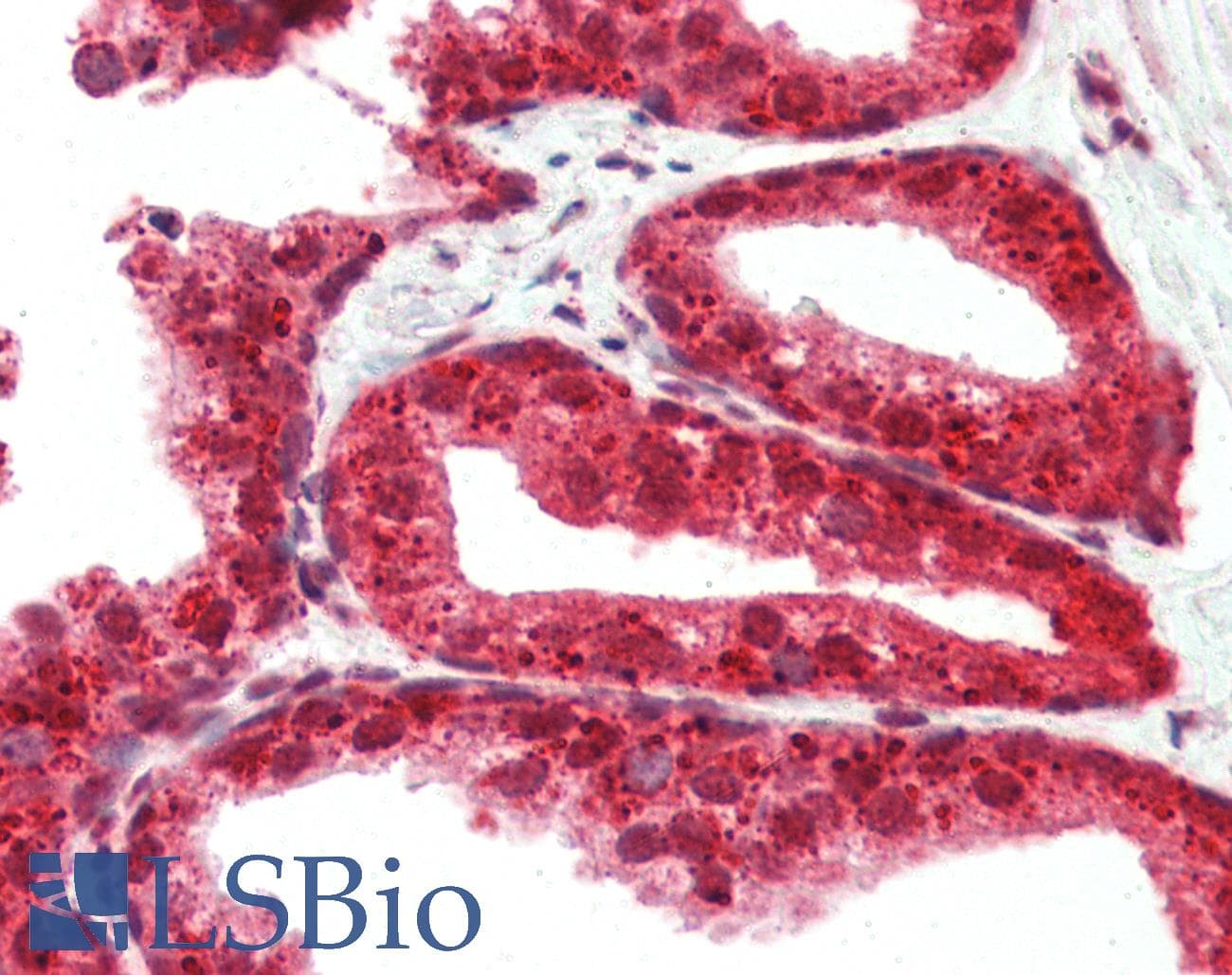 IHC-plus™ RASD2 Antibody