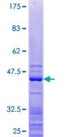 Human RPL27 / Ribosomal Protein L27 (Recombinant GST)