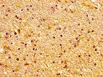 Polyclonal Rabbit anti-Human LASS1 Antibody (IHC, WB)