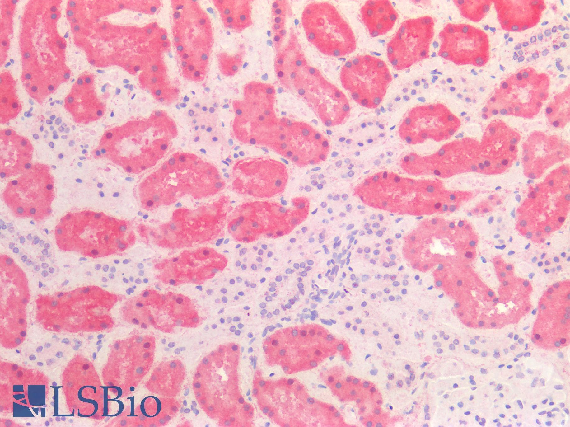 PathPlus™ HSPD1 / HSP60 Antibody