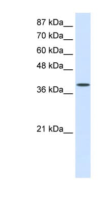 DAP-5 / EIF4G2 Antibody (aa766-815)