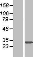 Human SLC35E2 Protein (Over-Expression Lysate Myc-DDK (Flag))