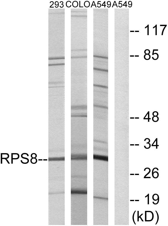 RPS8 / Ribosomal Protein S8 Antibody