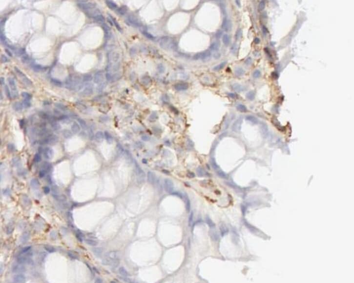 COL4A1 / Collagen IV Alpha1 Antibody