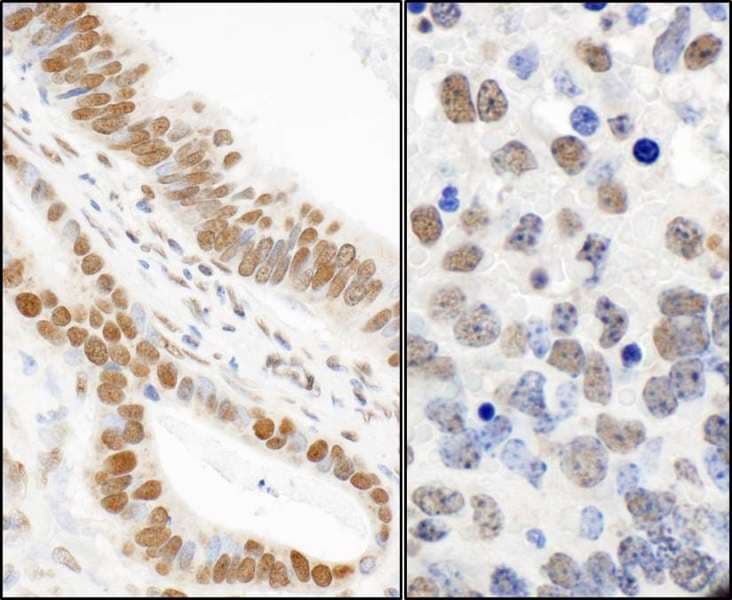 Polyclonal Rabbit anti-Human TP53BP1 / 53BP1 Antibody (phospho-Ser25, IHC, WB)