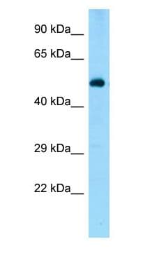 Polyclonal Rabbit anti-Rat ZNF851 / ZBTB44 Antibody (N-Terminus, WB)