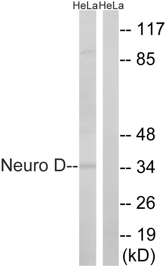 NEUROD1 Antibody (aa240-289)