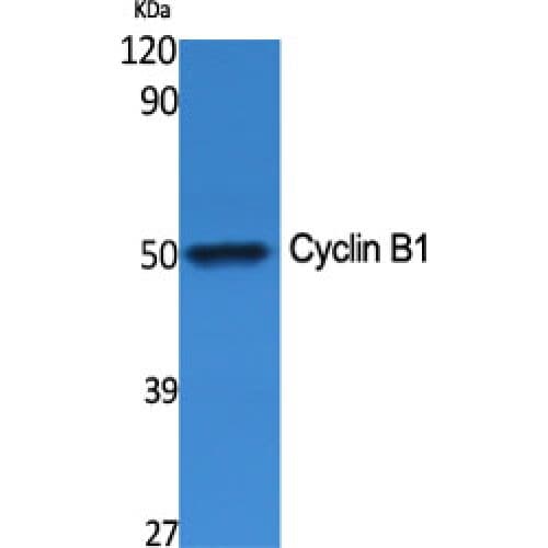 Polyclonal Rabbit anti-Human CCNB1 / Cyclin B1 Antibody (60-140 aa, IHC, IF, WB)