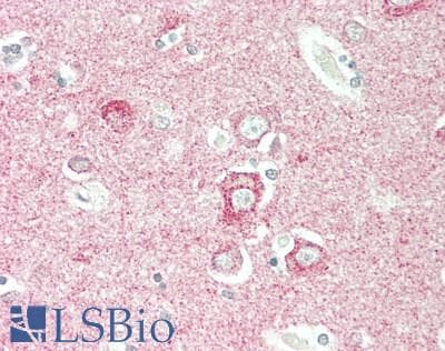 Polyclonal Rabbit anti-Human OSMR / IL-31R-Beta Antibody (aa513-760, IHC, WB)