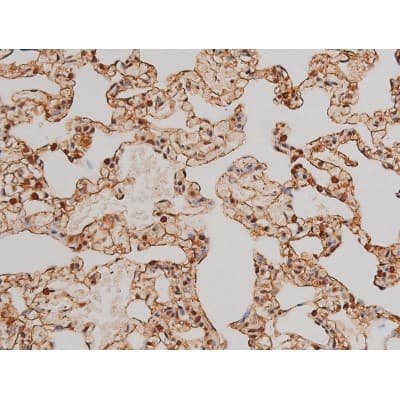 Polyclonal Rabbit anti-Human FLNA / Filamin A Antibody (phospho-Ser2152, IHC, IF, WB)