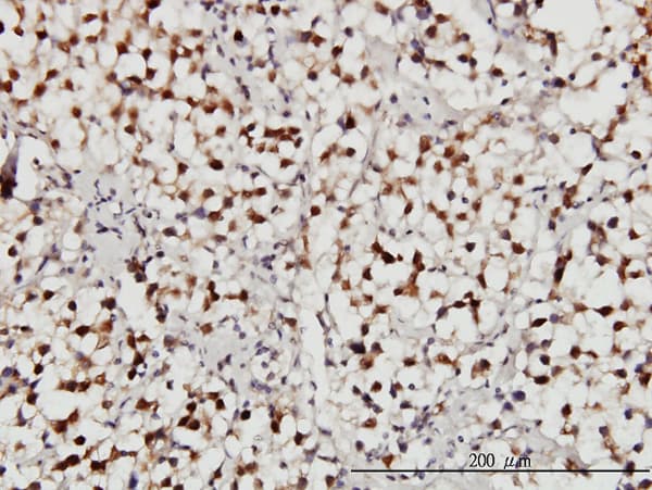 USP34 Antibody (clone 2E2)