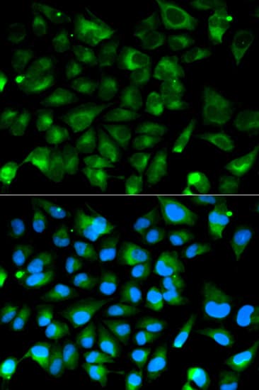 IHC-plus™ Polyclonal Rabbit anti-Human PRKAR1A Antibody (IHC, IF, WB)