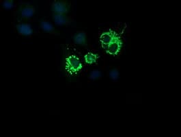 Monoclonal Mouse anti-Human CMPK / CMPK1 Antibody (clone OTI2B2, IHC, IF, WB)