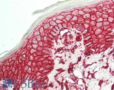 PathPlus™ CD44 Antibody (aa1-258)