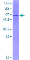 Human HSD17B7 / PRAP Protein (Recombinant GST)