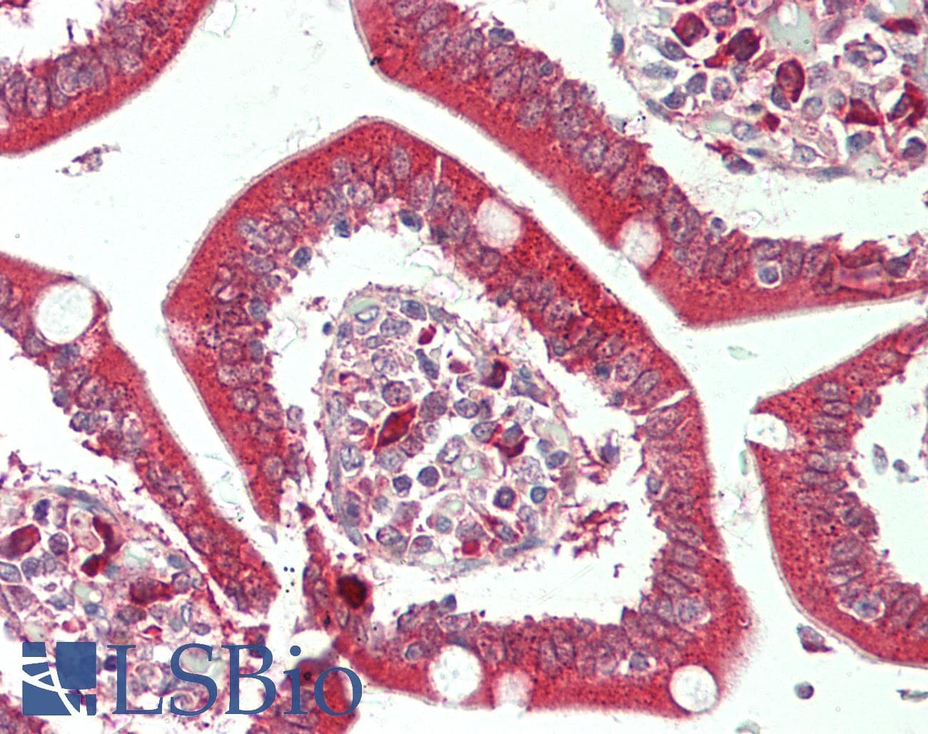 IHC-plus™ HUNK / B19 Antibody (aa238-287)
