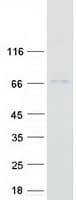 Human BIRC2 / cIAP1 Protein (Recombinant Myc-DDK (Flag))