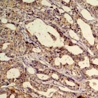 AKT1 Antibody