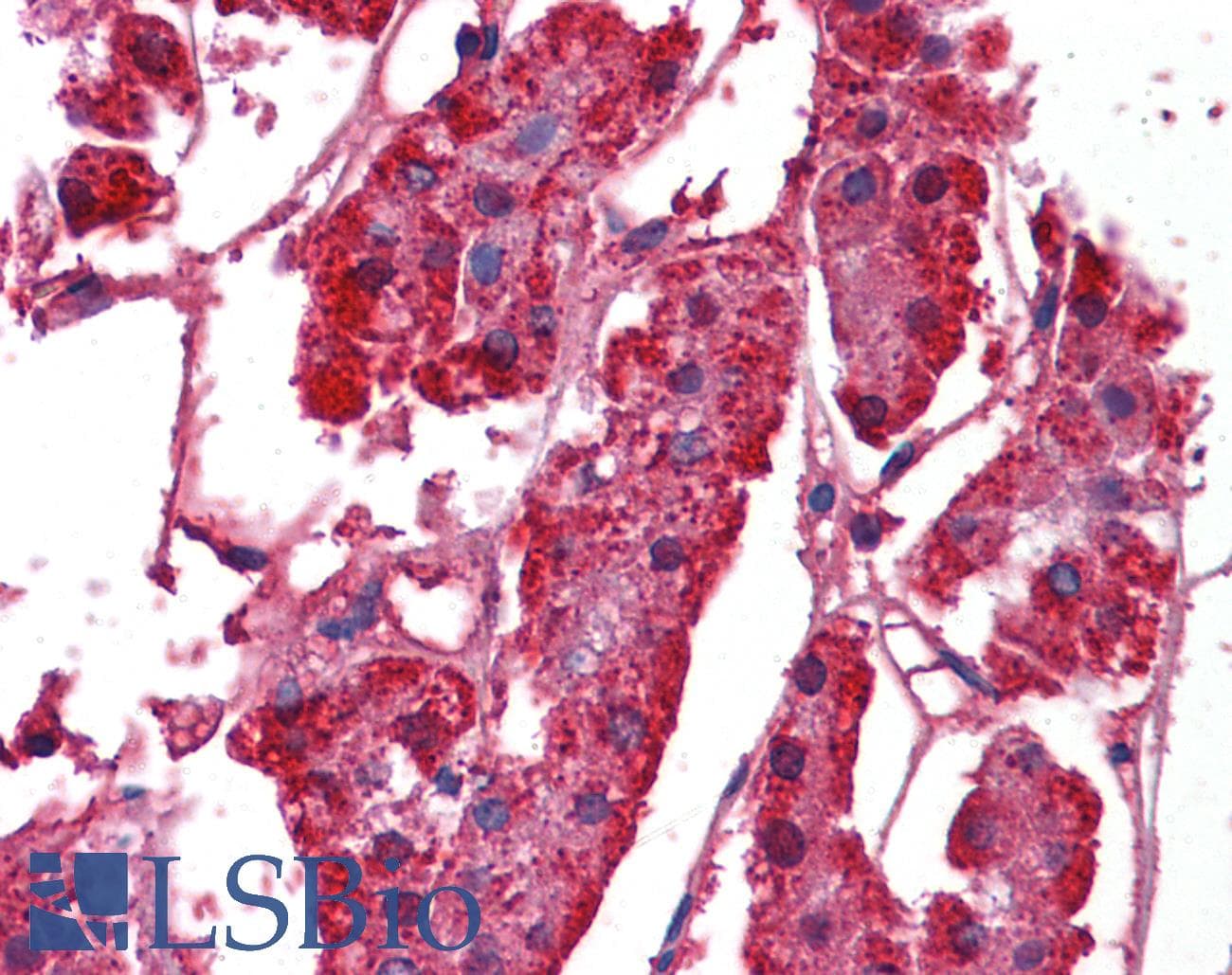 IHC-plus™ SRPX2 Antibody