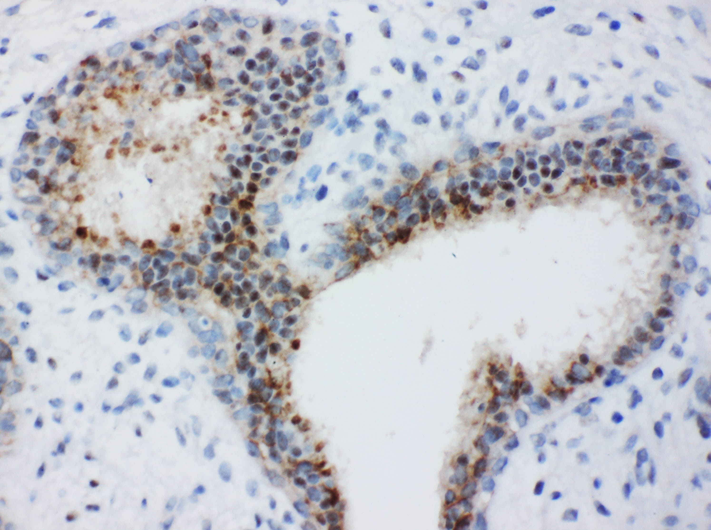 BUB3 Antibody (aa76-90)