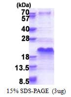Human SHSF1 / SHFM1 Protein (Recombinant His)